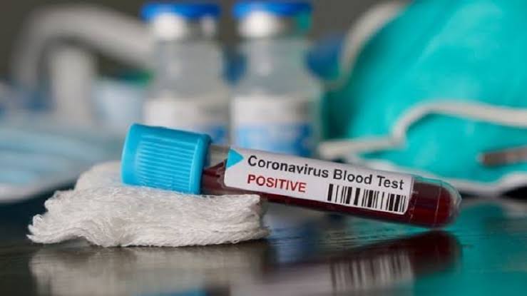 Update Covid-19, Positif 6 Kasus dan Sembuh 1 