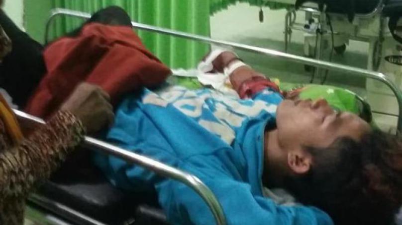 Dibegal Serta Tangan Ditebas, Motor Seorang Remaja Raib