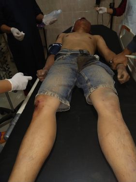 Terciduk Saat Hendak Maling Motor, Satu Dari Dua Pelaku Diamuk Massa