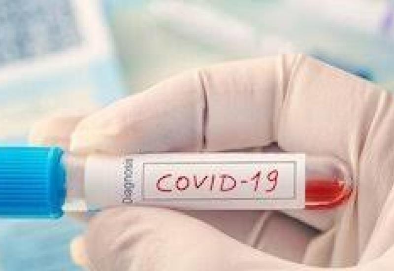 2 Tambahan Kasus Positif Covid-19, 3 Dinyatakan Sembuh