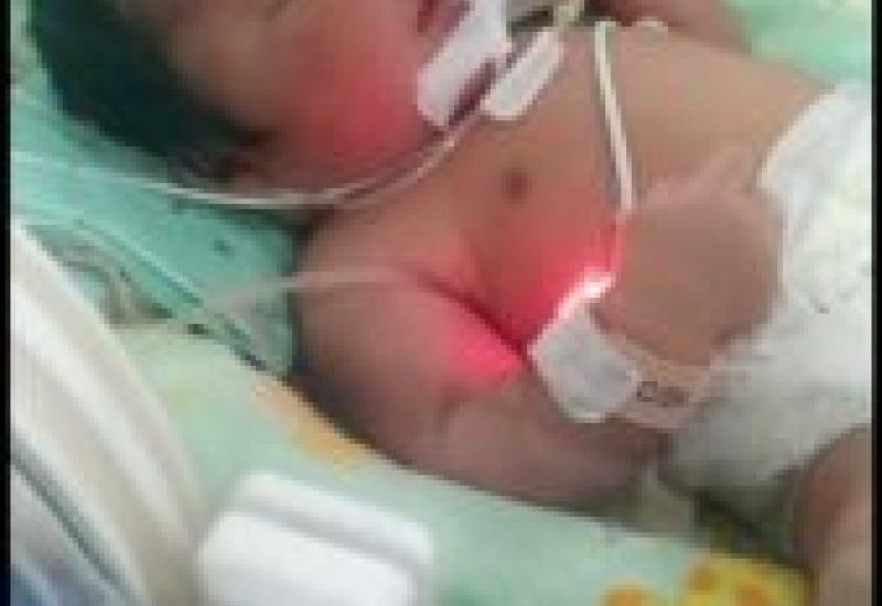 Didiagnosa Jantung Bocor, Bayi Hanif Ghafi Kusmaya Harus Jalani Operasi